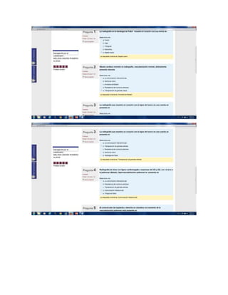 Pasos cardio diagnostico II