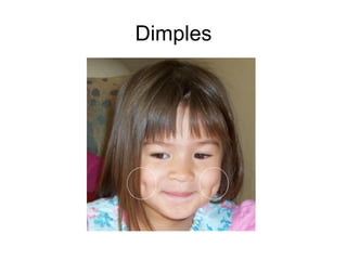 Dimples 