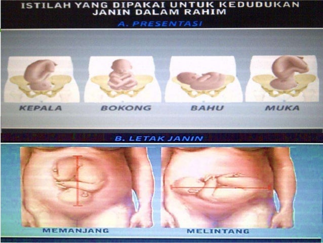 Faktor yang Mempengaruhi Persalinan(Passanger)