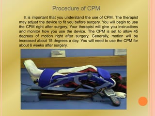Procedure of CPM
It is important that you understand the use of CPM. The therapist
may adjust the device to fit you before surgery. You will begin to use
the CPM right after surgery. Your therapist will give you instructions
and monitor how you use the device. The CPM is set to allow 45
degrees of motion right after surgery. Generally, motion will be
increased about 15 degrees a day. You will need to use the CPM for
about 6 weeks after surgery.
 