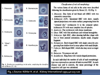 Fig. 1 Source: Köhler H. et al . Kidney International 1991;40:115-120
 