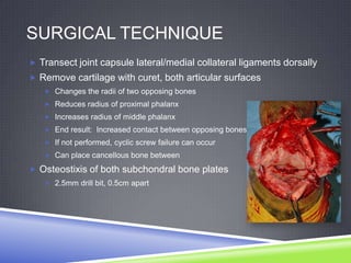 SURGICAL TECHNIQUE
 Transect joint capsule lateral/medial collateral ligaments dorsally
 Remove cartilage with curet, both articular surfaces
    Changes the radii of two opposing bones
    Reduces radius of proximal phalanx
    Increases radius of middle phalanx
    End result: Increased contact between opposing bones
    If not performed, cyclic screw failure can occur
    Can place cancellous bone between

 Osteostixis of both subchondral bone plates
    2.5mm drill bit, 0.5cm apart
 