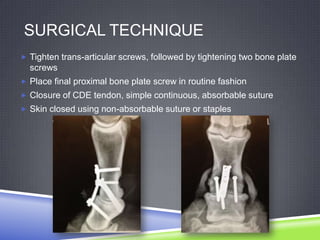 SURGICAL TECHNIQUE
 Tighten trans-articular screws, followed by tightening two bone plate
  screws
 Place final proximal bone plate screw in routine fashion
 Closure of CDE tendon, simple continuous, absorbable suture
 Skin closed using non-absorbable suture or staples
 