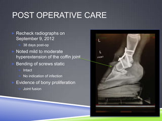 POST OPERATIVE CARE

 Recheck radiographs on
  September 9, 2012
    38 days post-op

 Noted mild to moderate
  hyperextension of the coffin joint
 Bending of screws static
    Intact
    No indication of infection

 Evidence of bony proliferation
    Joint fusion
 
