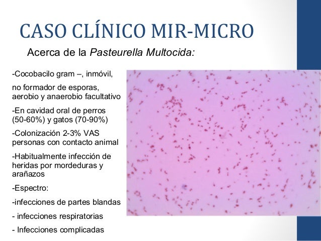 Pasteurella multocida: Bacteriemia y posible endocarditis Pasteurella multocida: Bacteriemia y posible endocarditis