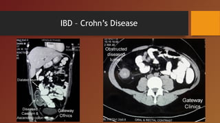 Past present future - laparoscopic colorectal surgery | PPT