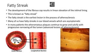 Comprehensive Overview of Cardiovascular Pathology: Atherosclerosis ...