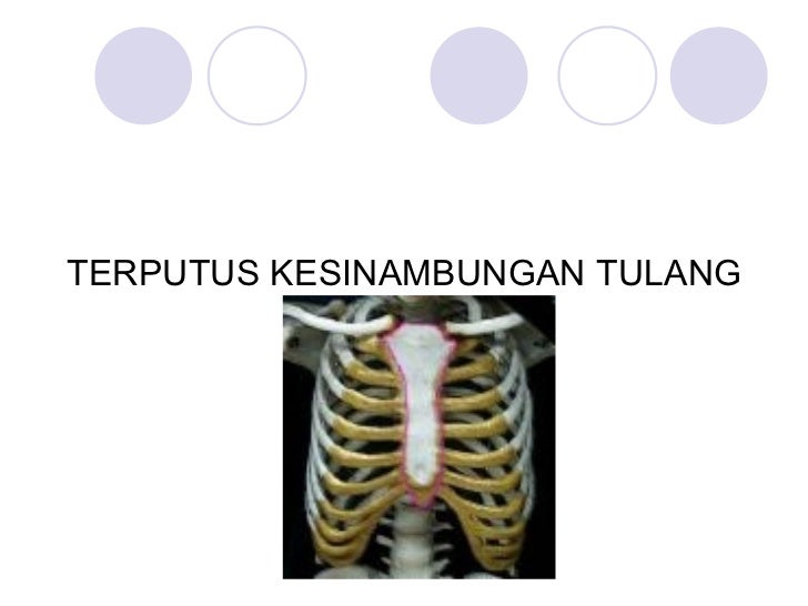 Patah