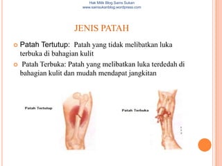 Hak Milik Blog Sains Sukan
                      www.sainsukanblog.wordpress.com




                   JENIS PATAH
 Patah Tertutup: Patah yang tidak melibatkan luka
  terbuka di bahagian kulit
 Patah Terbuka: Patah yang melibatkan luka terdedah di
  bahagian kulit dan mudah mendapat jangkitan
 