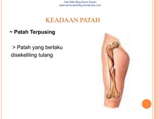 Hak Milik Blog Sains Sukan
                    www.sainsukanblog.wordpress.com




              KEADAAN PATAH
~ Patah Terpusing

 > Patah yang berlaku
disekeliling tulang
 