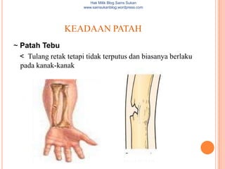 Hak Milik Blog Sains Sukan
                       www.sainsukanblog.wordpress.com




                KEADAAN PATAH
~ Patah Tebu
  < Tulang retak tetapi tidak terputus dan biasanya berlaku
  pada kanak-kanak
 