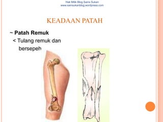 Hak Milik Blog Sains Sukan
                  www.sainsukanblog.wordpress.com




             KEADAAN PATAH
~ Patah Remuk
 < Tulang remuk dan
   bersepeh
 