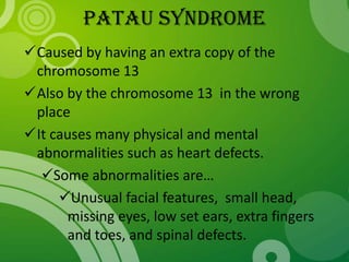 Patau syndrome physical characteristics