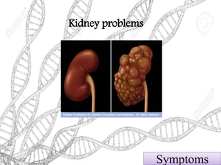 Kidney problems
Symptoms
 