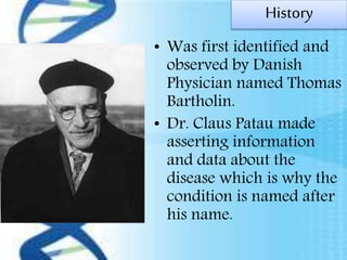 History
• Was first identified and
observed by Danish
Physician named Thomas
Bartholin.
• Dr. Claus Patau made
asserting information
and data about the
disease which is why the
condition is named after
his name.
 