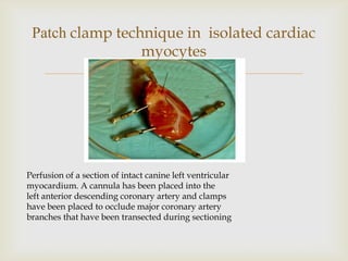 Patch clamp technique in isolated cardiac
                 myocytes
                                    


Perfusion of a section of intact canine left ventricular
myocardium. A cannula has been placed into the
left anterior descending coronary artery and clamps
have been placed to occlude major coronary artery
branches that have been transected during sectioning
 