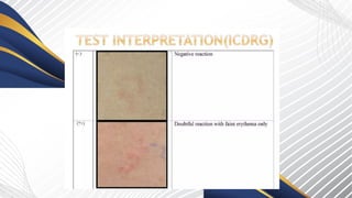 patch test in dermatology principle, indications | PPTX