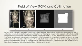 Radiation Dose Management for Patients in Medical Imaging- Avinesh ...