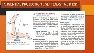 teknik pemeriksaan radiologi patella dengan 4 posisi | PPTX