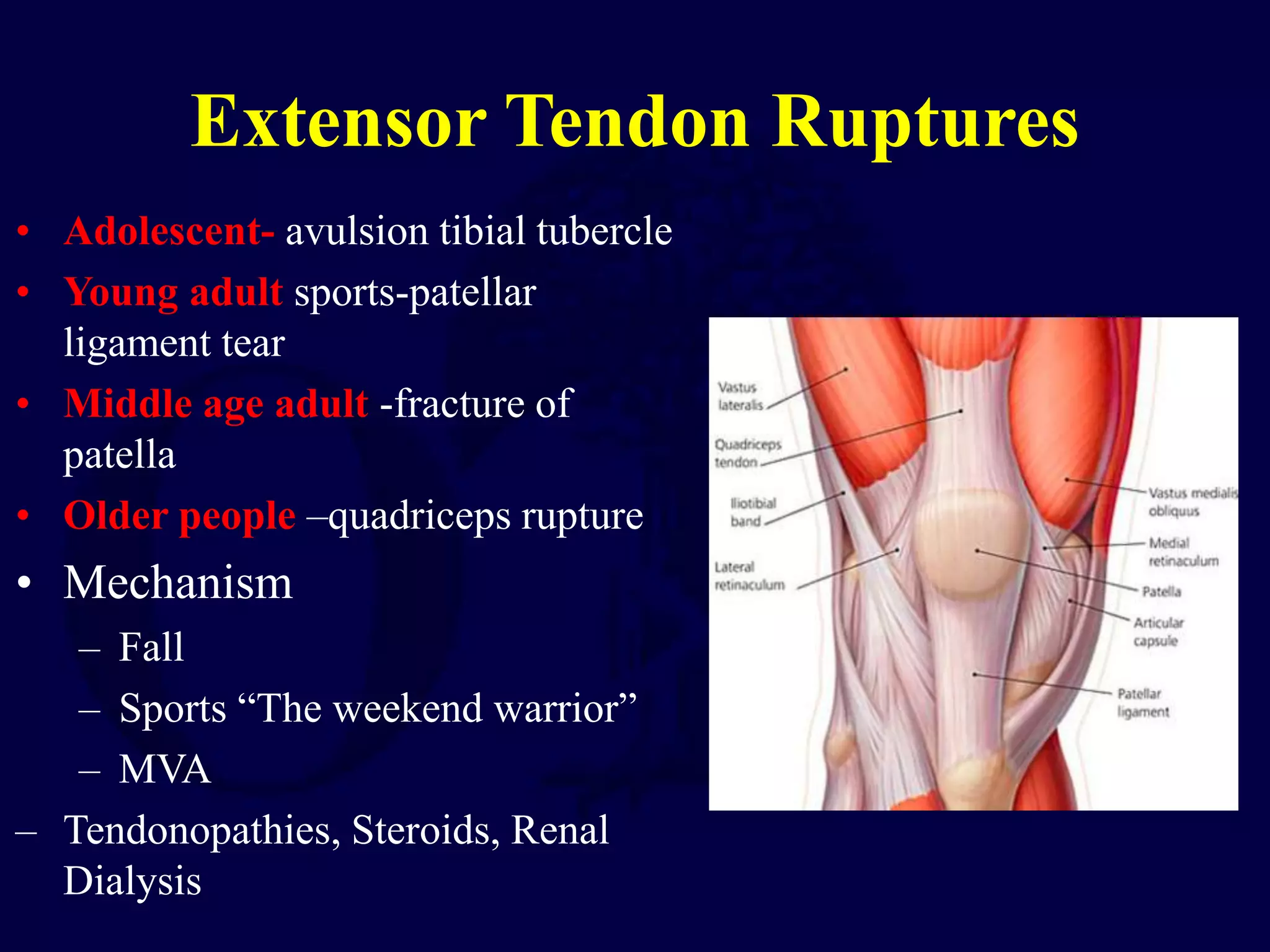 Extensor Tendon Ruptures
• Adolescent- avulsion tibial tubercle
• Young adult sports-patellar
ligament tear
• Middle age adult -fracture of
patella
• Older people –quadriceps rupture
• Mechanism
– Fall
– Sports “The weekend warrior”
– MVA
– Tendonopathies, Steroids, Renal
Dialysis
 
