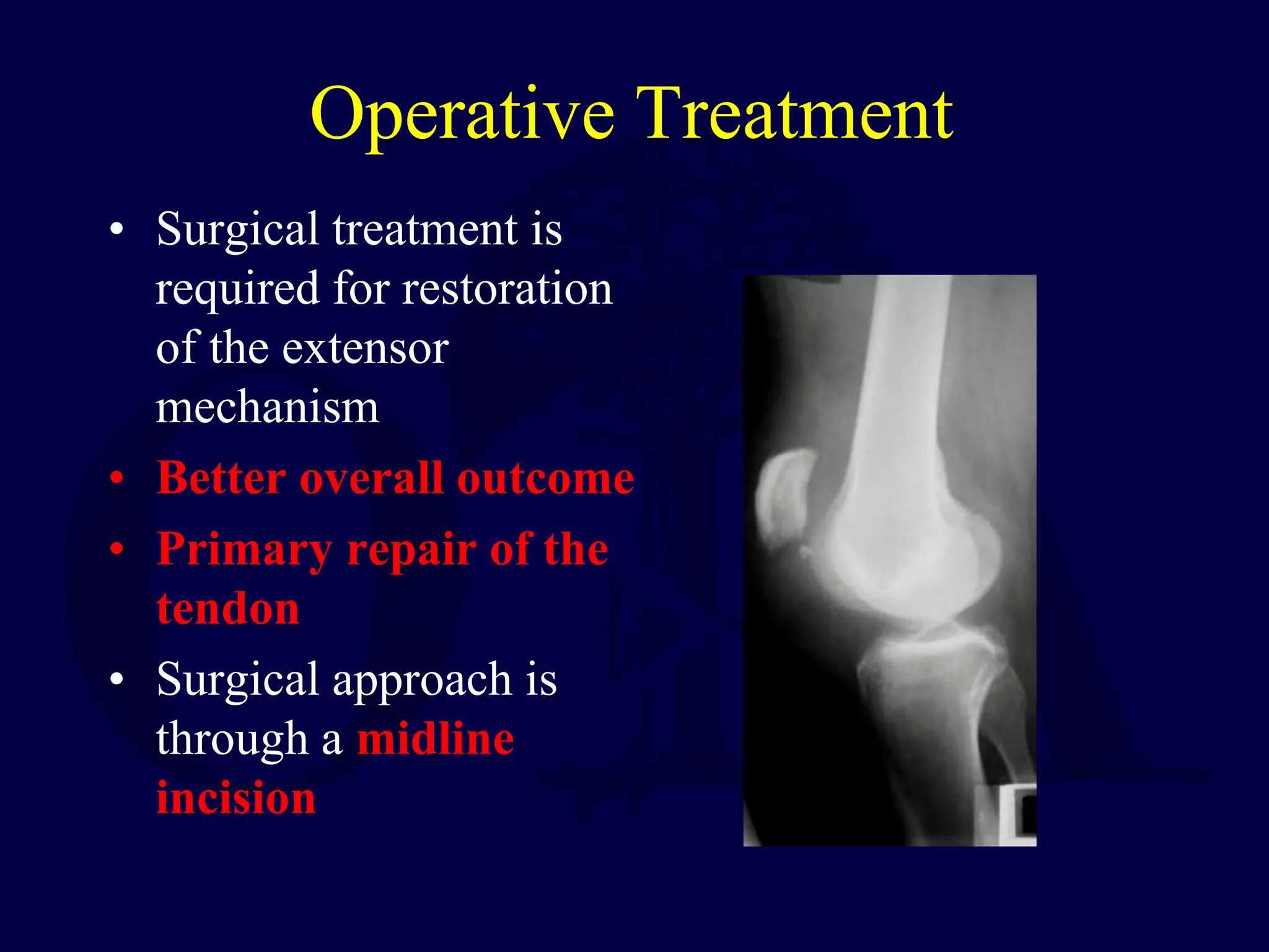 Operative Treatment
• Surgical treatment is
required for restoration
of the extensor
mechanism
• Better overall outcome
• Primary repair of the
tendon
• Surgical approach is
through a midline
incision
 