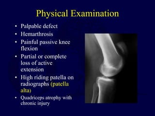 Patella fx and mechanism injuries | PPT