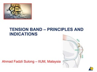 TENSION BAND – PRINCIPLES AND
INDICATIONS
Ahmad Fadzli Sulong – IIUM, Malaysia
 