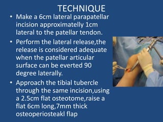 Patella dislocation by DR.NAVEEN RATHOR | PPTX