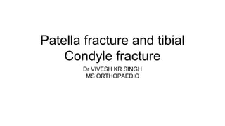 Patella fracture and tibial
Condyle fracture
Dr VIVESH KR SINGH
MS ORTHOPAEDIC
 