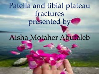 Patella and tibial plateau
fractures
presented by
Aisha Motaher Abutaleb
 