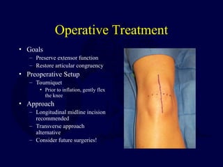 Operative Treatment
• Goals
– Preserve extensor function
– Restore articular congruency
• Preoperative Setup
– Tourniquet
• Prior to inflation, gently flex
the knee
• Approach
– Longitudinal midline incision
recommended
– Transverse approach
alternative
– Consider future surgeries!
 