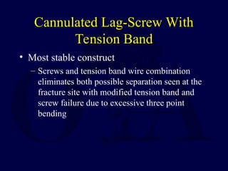 Cannulated Lag-Screw With
Tension Band
• Most stable construct
– Screws and tension band wire combination
eliminates both possible separation seen at the
fracture site with modified tension band and
screw failure due to excessive three point
bending
 