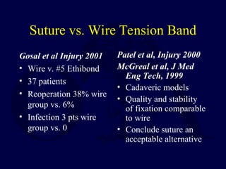 Suture vs. Wire Tension Band
Gosal et al Injury 2001
• Wire v. #5 Ethibond
• 37 patients
• Reoperation 38% wire
group vs. 6%
• Infection 3 pts wire
group vs. 0
Patel et al, Injury 2000
McGreal et al, J Med
Eng Tech, 1999
• Cadaveric models
• Quality and stability
of fixation comparable
to wire
• Conclude suture an
acceptable alternative
 