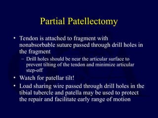 Partial Patellectomy
• Tendon is attached to fragment with
nonabsorbable suture passed through drill holes in
the fragment
– Drill holes should be near the articular surface to
prevent tilting of the tendon and minimize articular
step-off
• Watch for patellar tilt!
• Load sharing wire passed through drill holes in the
tibial tubercle and patella may be used to protect
the repair and facilitate early range of motion
 