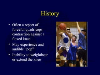 History
• Often a report of
forceful quadriceps
contraction against a
flexed knee
• May experience and
audible “pop”
• Inability to weightbear
or extend the knee
 