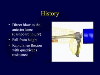 History
• Direct blow to the
anterior knee
(dashboard injury)
• Fall from height
• Rapid knee flexion
with quadriceps
resistance
 