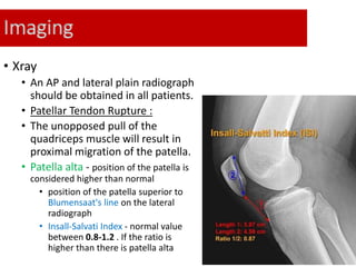 Imaging
• Xray
• An AP and lateral plain radiograph
should be obtained in all patients.
• Patellar Tendon Rupture :
• The unopposed pull of the
quadriceps muscle will result in
proximal migration of the patella.
• Patella alta - position of the patella is
considered higher than normal
• position of the patella superior to
Blumensaat's line on the lateral
radiograph
• Insall-Salvati Index - normal value
between 0.8-1.2 . If the ratio is
higher than there is patella alta
 