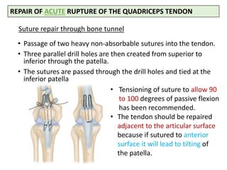 Suture repair through bone tunnel
• Passage of two heavy non-absorbable sutures into the tendon.
• Three parallel drill holes are then created from superior to
inferior through the patella.
• The sutures are passed through the drill holes and tied at the
inferior patella
REPAIR OF ACUTE RUPTURE OF THE QUADRICEPS TENDON
• Tensioning of suture to allow 90
to 100 degrees of passive flexion
has been recommended.
• The tendon should be repaired
adjacent to the articular surface
because if sutured to anterior
surface it will lead to tilting of
the patella.
 