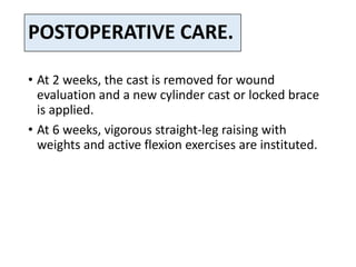 POSTOPERATIVE CARE.
• At 2 weeks, the cast is removed for wound
evaluation and a new cylinder cast or locked brace
is applied.
• At 6 weeks, vigorous straight-leg raising with
weights and active flexion exercises are instituted.
 