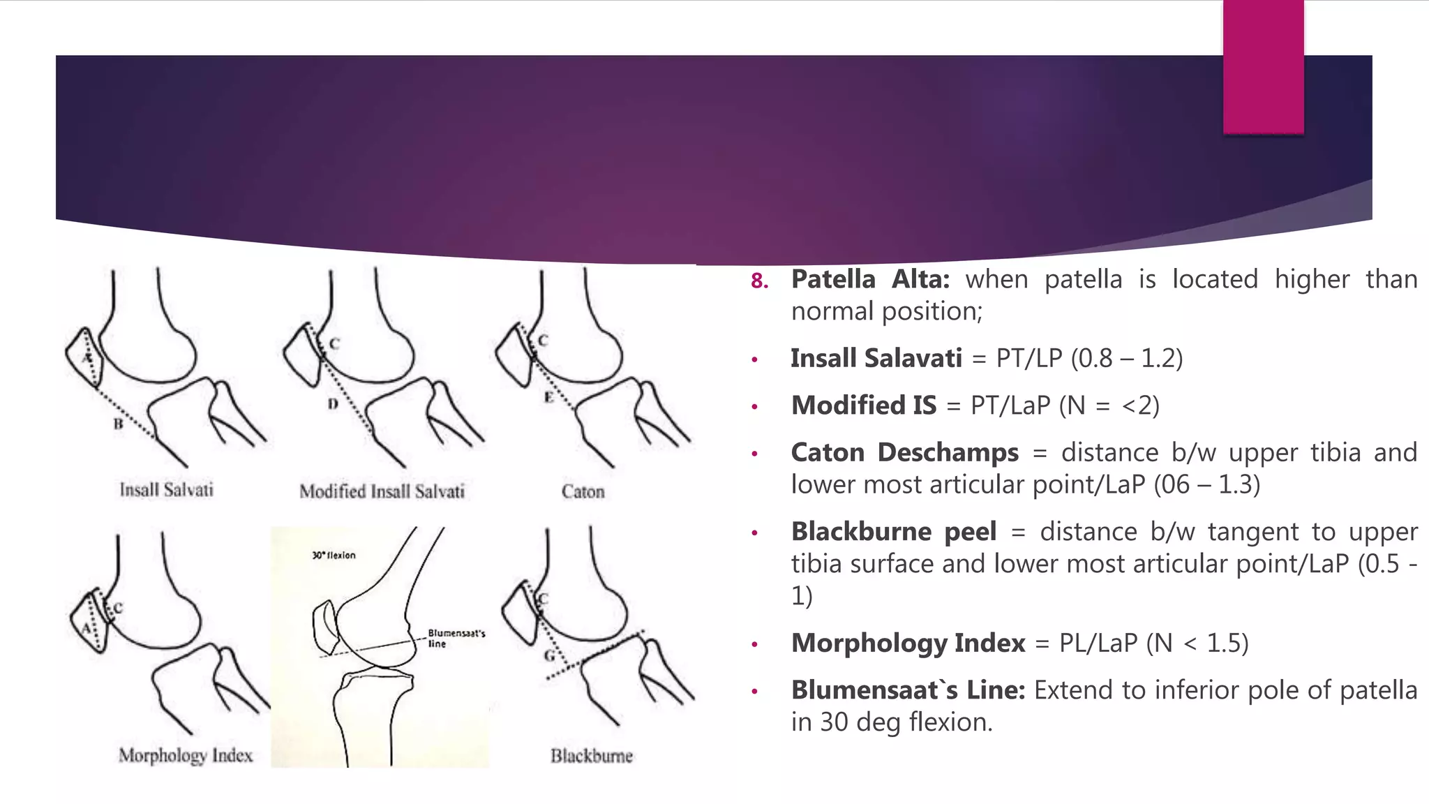 8. Patella Alta: when patella is located higher than
normal position;
• Insall Salavati = PT/LP (0.8 – 1.2)
• Modified IS = PT/LaP (N = <2)
• Caton Deschamps = distance b/w upper tibia and
lower most articular point/LaP (06 – 1.3)
• Blackburne peel = distance b/w tangent to upper
tibia surface and lower most articular point/LaP (0.5 -
1)
• Morphology Index = PL/LaP (N < 1.5)
• Blumensaat`s Line: Extend to inferior pole of patella
in 30 deg flexion.
 