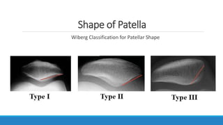 Patellar Instability | PPTX