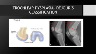 Patellar instability.pptx , introduction, anatomy | PPTX