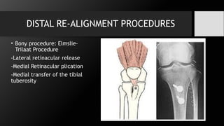 Patellar instability.pptx , introduction, anatomy | PPTX