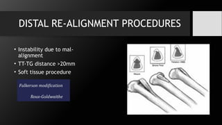 Patellar instability.pptx , introduction, anatomy | PPTX