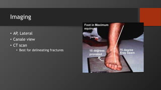 Imaging
• AP, Lateral
• Canale view
• CT scan
• Best for delineating fractures
 