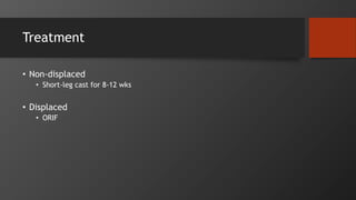 Treatment
• Non-displaced
• Short-leg cast for 8-12 wks
• Displaced
• ORIF
 