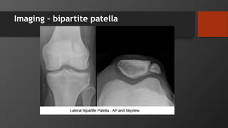 Imaging – bipartite patella
 