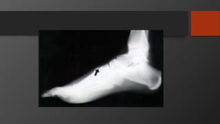 Patella, tibia, foot and ankle injuries