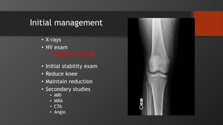 Initial management
• X-rays
• NV exam
• Vascular is priority
• Initial stability exam
• Reduce knee
• Maintain reduction
• Secondary studies
• MRI
• MRA
• CTA
• Angio
 