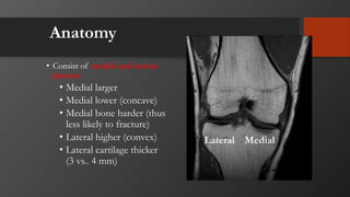 Anatomy
• Consist of medial and lateral
plateau
• Medial larger
• Medial lower (concave)
• Medial bone harder (thus
less likely to fracture)
• Lateral higher (convex)
• Lateral cartilage thicker
(3 vs.. 4 mm)
MedialLateral
 